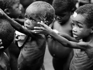There Is Severe Malnourished Children In Seven Northern States – MSF 43 Malnurished children 1024x577 1