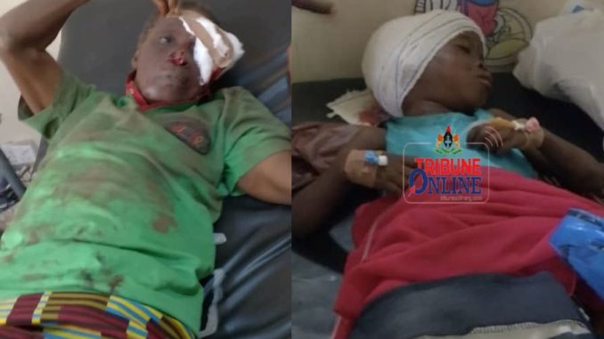 Dog Eats Flesh Off Girl’s Head, Attacks Owner Trying To Protect Victim In Apete Ibadan 1 18550984 img6650 jpeg jpegcb6e428392924bfab53170502ef7a743