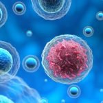 Cancer Now Curable, Late Presentation Cause Of Deaths - Oncologists