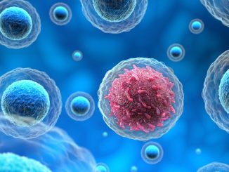 Cancer Now Curable, Late Presentation Cause Of Deaths - Oncologists 59 Cancer Now Curable, Late Presentation Cause Of Deaths - Oncologists