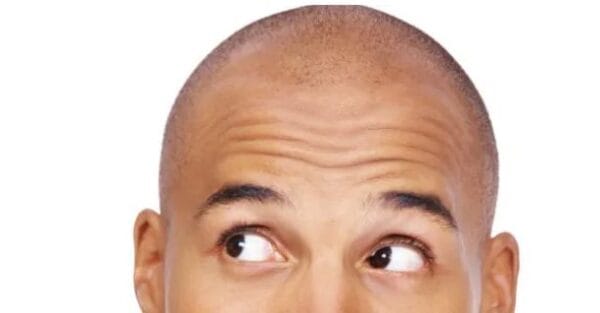 5 genius ways to hide a bald patch 1 5 genius ways to hide a bald patch