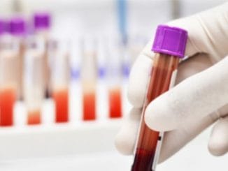 This blood type is so rare that only 43 people have it in the world 6 This blood type is so rare that only 43 people have it in the world