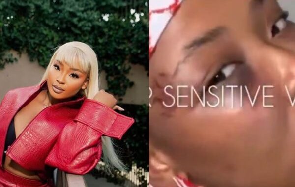 Cyan Boujee Shows Bruised Face, Claims Abuse by Boyfriend (Video)