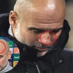 Guardiola Clarifies Self-Harm Comments After Post-Match Joke About Scratches on His Face