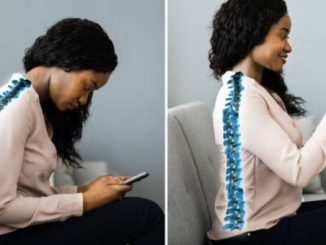 How too much phone use is damaging your body posture